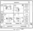 Fig. 30 - ALGORITHM-BASED OPTIMIZATION FOR KNEE ARTHROPLASTY PROCEDURES