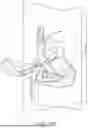 Fig. 32 - ALGORITHM-BASED OPTIMIZATION FOR KNEE ARTHROPLASTY PROCEDURES