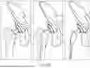 Fig. 34 - ALGORITHM-BASED OPTIMIZATION FOR KNEE ARTHROPLASTY PROCEDURES