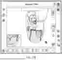 Fig. 40 - ALGORITHM-BASED OPTIMIZATION FOR KNEE ARTHROPLASTY PROCEDURES