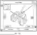 Fig. 41 - ALGORITHM-BASED OPTIMIZATION FOR KNEE ARTHROPLASTY PROCEDURES