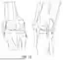Fig. 43 - ALGORITHM-BASED OPTIMIZATION FOR KNEE ARTHROPLASTY PROCEDURES