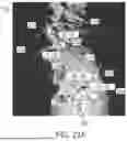Fig. 47 - ALGORITHM-BASED OPTIMIZATION FOR KNEE ARTHROPLASTY PROCEDURES