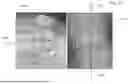Fig. 59 - ALGORITHM-BASED OPTIMIZATION FOR KNEE ARTHROPLASTY PROCEDURES