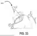 Fig. 61 - ALGORITHM-BASED OPTIMIZATION FOR KNEE ARTHROPLASTY PROCEDURES