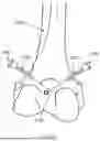 Fig. 65 - ALGORITHM-BASED OPTIMIZATION FOR KNEE ARTHROPLASTY PROCEDURES