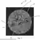 Fig. 07 - FIBROUS STRUCTURES COMPRISING REGIONS HAVING DIFFERENT MICRO-CT INTENSIVE PROPERTY VALUES AND ASSOCIATED TRANSITION SLOPES