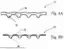 Fig. 09 - FIBROUS STRUCTURES COMPRISING REGIONS HAVING DIFFERENT MICRO-CT INTENSIVE PROPERTY VALUES AND ASSOCIATED TRANSITION SLOPES