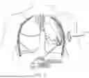 Fig. 14 - SURGICAL TOOL SYSTEM HAVING MULTIPLE TOOL TIP INTERFACES