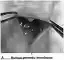 Fig. 01 - METHODS AND COMPOSITIONS FOR CELL TRANSPLANTATION