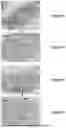 Fig. 04 - METHODS AND COMPOSITIONS FOR CELL TRANSPLANTATION