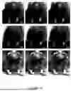 Fig. 60 - Methods and Systems for Modulating Cellular Activation