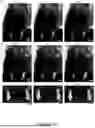 Fig. 61 - Methods and Systems for Modulating Cellular Activation