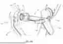 Fig. 15 - SURGICAL ROBOT SYSTEMS COMPRISING ROBOTIC TELEMANIPULATORS AND INTEGRATED LAPAROSCOPY