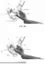 Fig. 16 - SURGICAL ROBOT SYSTEMS COMPRISING ROBOTIC TELEMANIPULATORS AND INTEGRATED LAPAROSCOPY