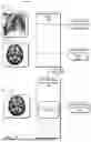 Fig. 02 - SPECTRAL ADAPTER FOR ADAPTIVE TRAINING OF TRANSFORMER NETWORKS