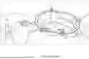 Fig. 03 - RETRACTOR SYSTEM FOR ABDOMINAL-WALL REPAIR