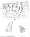 Fig. 05 - RETRACTOR SYSTEM FOR ABDOMINAL-WALL REPAIR
