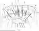 Fig. 06 - RETRACTOR SYSTEM FOR ABDOMINAL-WALL REPAIR