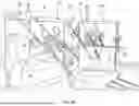 Fig. 07 - RETRACTOR SYSTEM FOR ABDOMINAL-WALL REPAIR