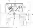Fig. 08 - RETRACTOR SYSTEM FOR ABDOMINAL-WALL REPAIR