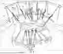 Fig. 11 - RETRACTOR SYSTEM FOR ABDOMINAL-WALL REPAIR
