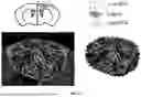 Fig. 06 - BIOMATERIALS FOR IMPROVING BRAIN HEALING AFTER STROKE AND METHODS OF USING SAME
