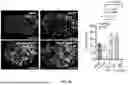 Fig. 07 - BIOMATERIALS FOR IMPROVING BRAIN HEALING AFTER STROKE AND METHODS OF USING SAME