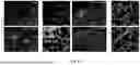 Fig. 22 - BIOMATERIALS FOR IMPROVING BRAIN HEALING AFTER STROKE AND METHODS OF USING SAME