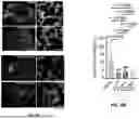 Fig. 33 - BIOMATERIALS FOR IMPROVING BRAIN HEALING AFTER STROKE AND METHODS OF USING SAME