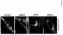 Fig. 05 - METHODS OF DIAGNOSING, DETERMINING THE PROGRESSION OF, AND TREATING A PROSTATE CANCER