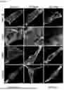 Fig. 06 - METHODS OF DIAGNOSING, DETERMINING THE PROGRESSION OF, AND TREATING A PROSTATE CANCER