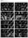 Fig. 07 - METHODS OF DIAGNOSING, DETERMINING THE PROGRESSION OF, AND TREATING A PROSTATE CANCER