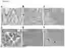Fig. 10 - METHODS OF DIAGNOSING, DETERMINING THE PROGRESSION OF, AND TREATING A PROSTATE CANCER