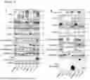 Fig. 12 - METHODS OF DIAGNOSING, DETERMINING THE PROGRESSION OF, AND TREATING A PROSTATE CANCER