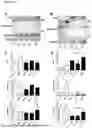 Fig. 33 - METHODS OF DIAGNOSING, DETERMINING THE PROGRESSION OF, AND TREATING A PROSTATE CANCER