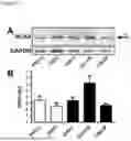 Fig. 46 - METHODS OF DIAGNOSING, DETERMINING THE PROGRESSION OF, AND TREATING A PROSTATE CANCER
