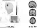 Fig. 07 - HELMET SYSTEM AND KIT