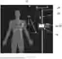 Fig. 01 - SUBARACHNOID FLUID MANAGEMENT METHOD AND SYSTEM WITH VARYING RATES
