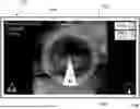 Fig. 01 - CAMERA POSITION INDICATION SYSTEMS AND METHODS