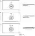 Fig. 15 - METHODS OF TREATING PATIENTS EXHIBITING A PRIOR FAILED THERAPY WITH HYPOIMMUNOGENIC CELLS