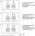Fig. 16 - METHODS OF TREATING PATIENTS EXHIBITING A PRIOR FAILED THERAPY WITH HYPOIMMUNOGENIC CELLS