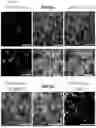 Fig. 21 - METHODS OF ON DEMAND IN VIVO PHOTOTAGGING