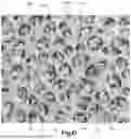 Fig. 08 - THREE-DIMENSIONAL POROUS STRUCTURES FOR BONE INGROWTH AND METHODS FOR PRODUCING