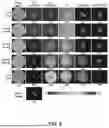 Fig. 10 - INCOHERENT HYBRID IMAGING SYSTEMS