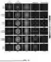 Fig. 15 - INCOHERENT HYBRID IMAGING SYSTEMS