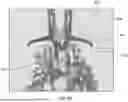 Fig. 18 - Low Power Implantable Glucose Sensors and Methods of Glucose Measurement