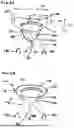 Fig. 03 - Corded Leaflet Free Edge Valve