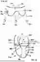 Fig. 04 - Corded Leaflet Free Edge Valve