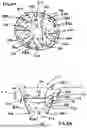 Fig. 08 - Corded Leaflet Free Edge Valve